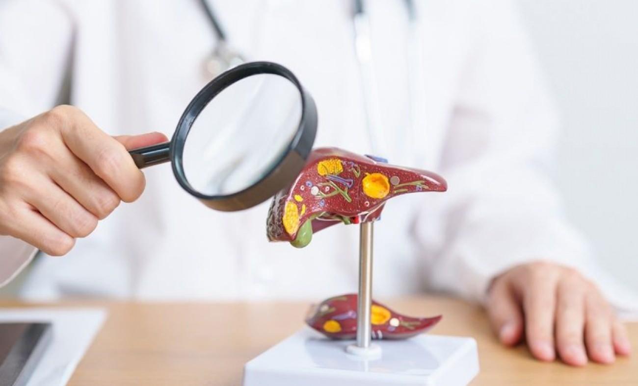 Tehdit artık uzakta değil: T&uuml;rkiye'de 10 yıl i&ccedil;inde 400 bin kişi siroz riskiyle karşı karşıya!