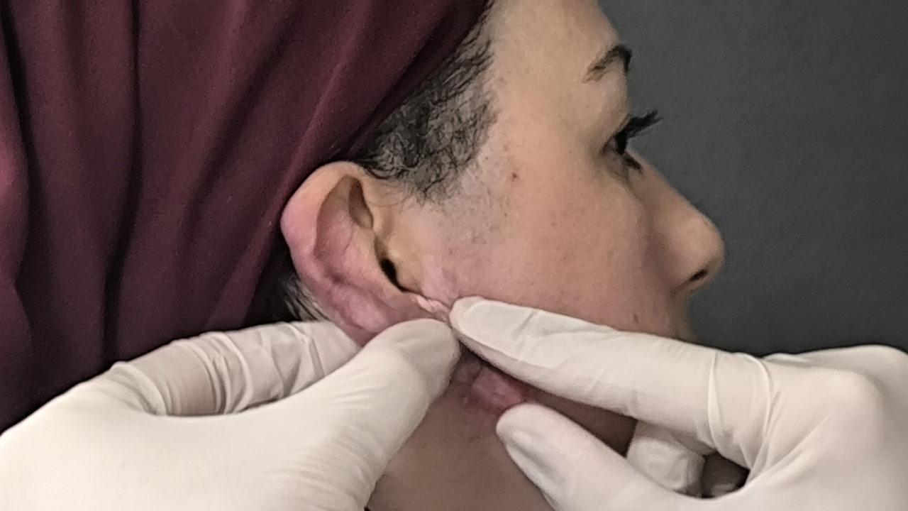 Op. Dr. Işık, düzenli kontrollerle iyileşme sürecinin takip edildiği söyledi.