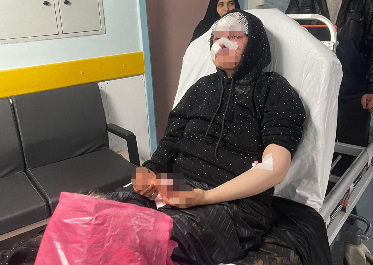 Nazlı Y.'nin (26) yoğun bakımdaki tedavisi devam ediyor. 