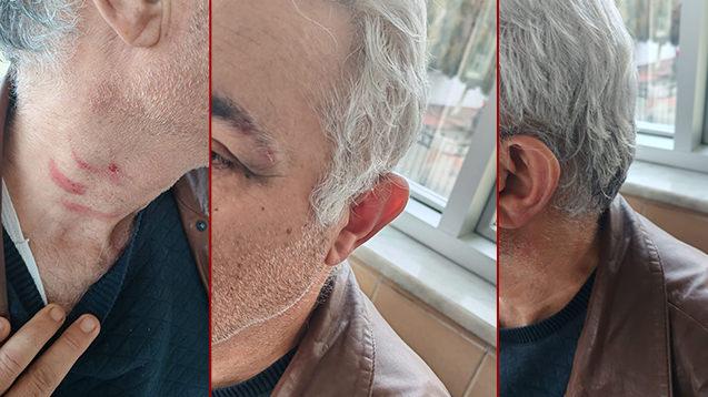 Aile Hekimi Dr. Ahmet Tolu, saldırıya uğradı.