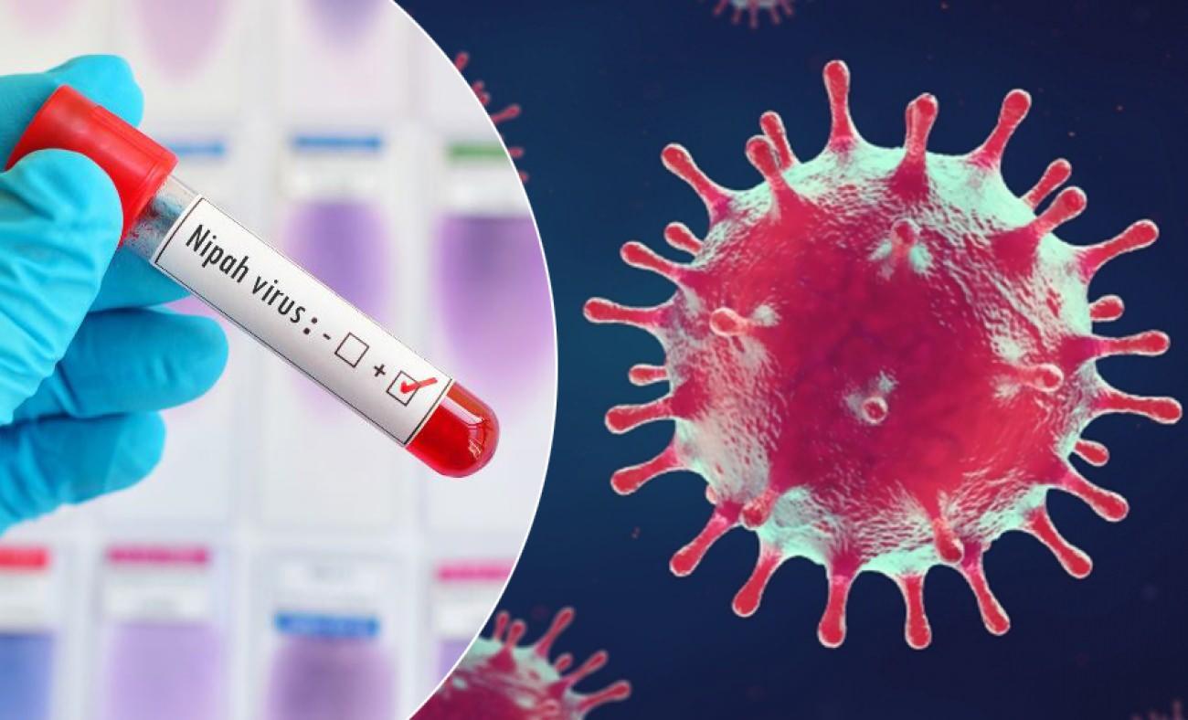 D&uuml;nya Sağlık &Ouml;rg&uuml;t&uuml; alarm verdi: Nipah vir&uuml;s&uuml; nedir, T&uuml;rkiye'de var mı?