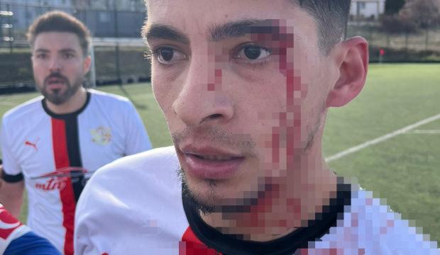 Yeşil sahada kan g&ouml;vdeyi g&ouml;t&uuml;rd&uuml;: 3 futbolcu hastanelik oldu