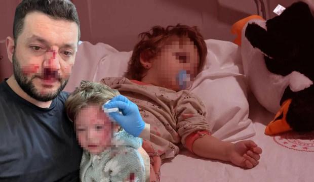 Baba ile 14 aylık bebeğin darbedildiği olayın g&ouml;r&uuml;nt&uuml;leri ortaya &ccedil;ıktı