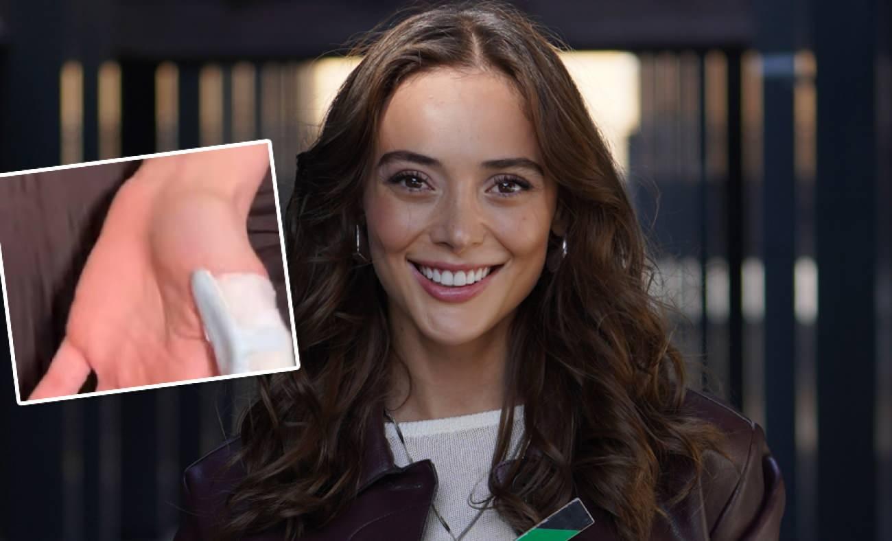 Rabia Soyt&uuml;rk sette kaza ge&ccedil;irdi! Parmağı kopma noktasına geldi