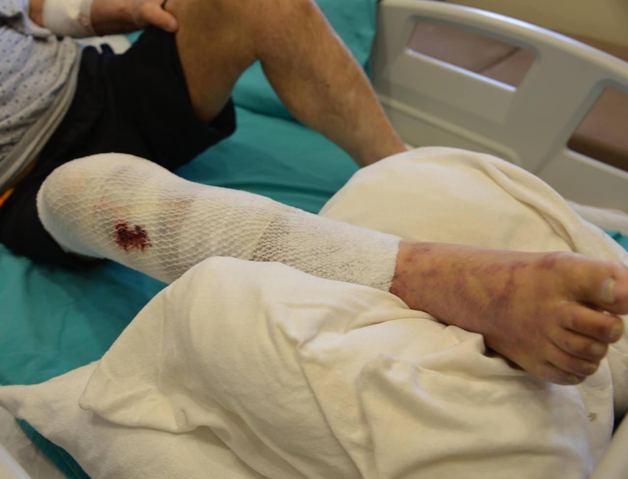 Uca'nın tedavisi sürüyor. 