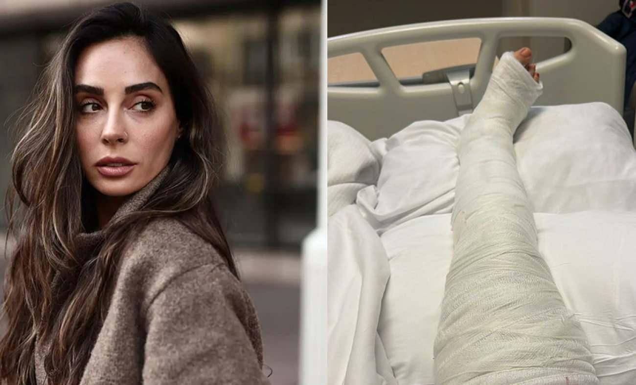 Talihsiz bir kaza ge&ccedil;irmişti! Hepsi'nin yıldızı Yasemin Y&uuml;r&uuml;k son durumunu paylaştı