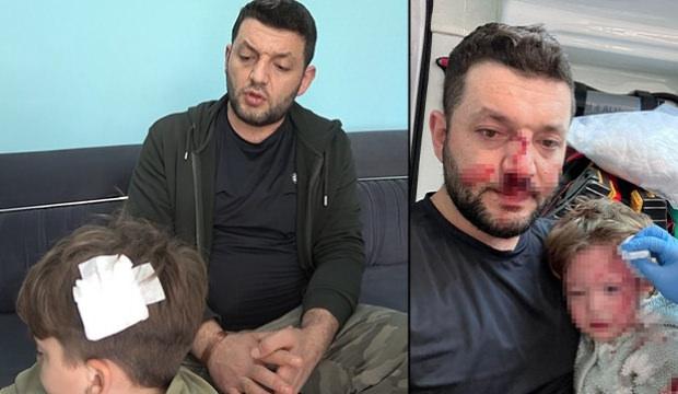 Yalova'da baba ile 14 aylık bebek darbedilmişti! Ailenin 8 yaşındaki &ccedil;ocuğu taşlandı