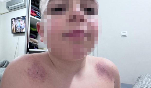 Antalya'da İlkokulda darp iddiası! Aile &ouml;ğretmenden şikayet&ccedil;i oldu