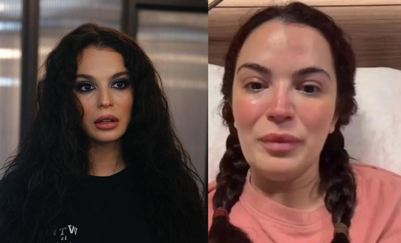 Doktor hatası y&uuml;z&uuml;nden 6 kez ameliyat oldu! Aslı Bekiroğlu son durumunu paylaştı