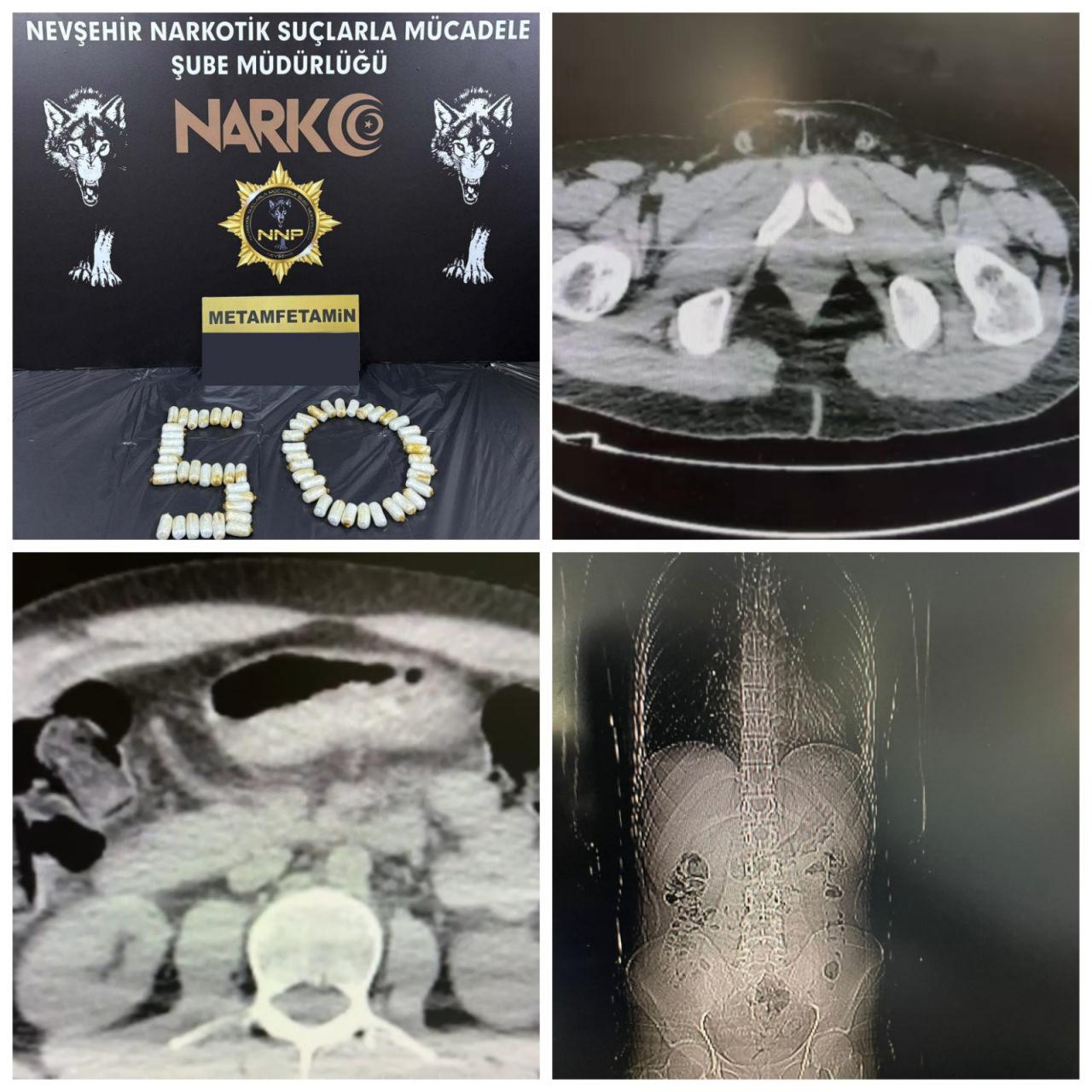 Yutma yöntemiyle uyuşturucu sevkiyatı.