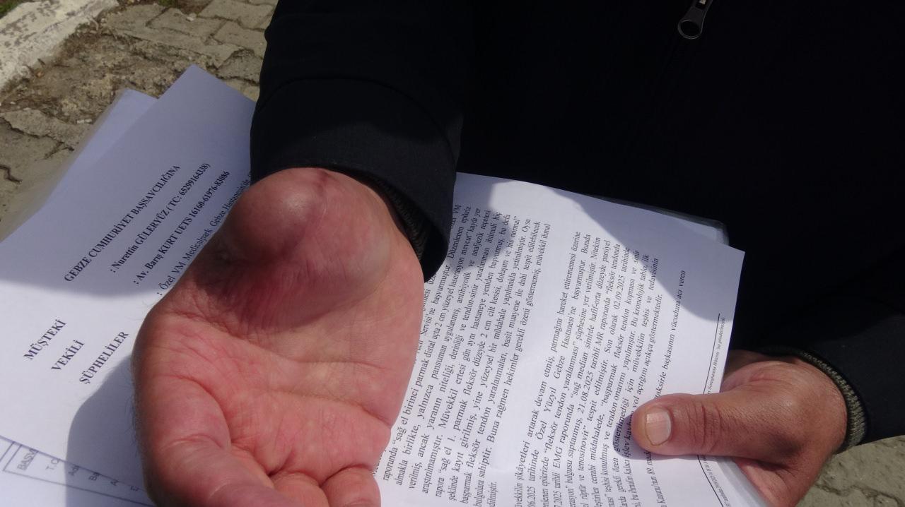 Nurettin Güleryüz'ün parmağı koptu. 