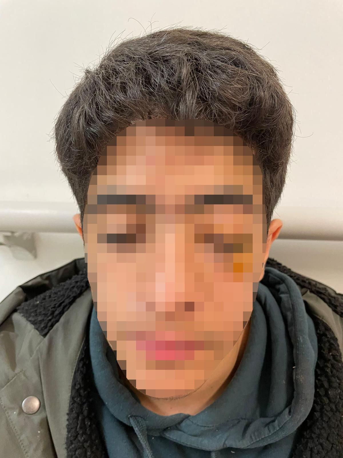 Bünyamin B. (15) uğradığı akran zorbalığının ardından bir gözünü kaybetme tehlikesiyle karşı karşıya. 