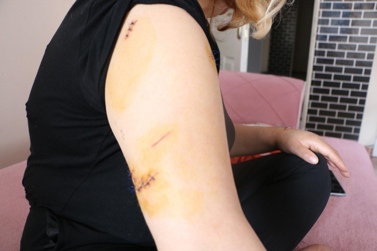  Diyarbakır’da dehşet: Nikahlı eşini 30 yerinden bıçakladı