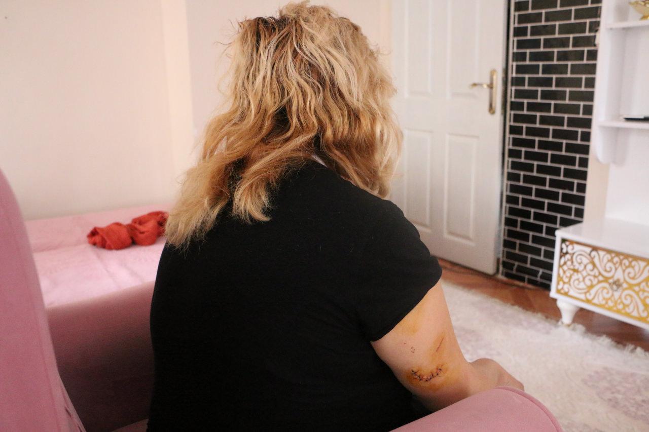 Eşi tarafından bıçaklı saldırıya uğrayan kadın.