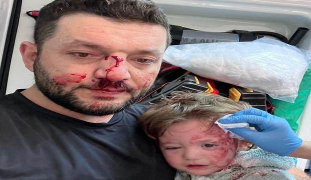 Kucağındaki bebeğiyle darbedilen babanın feryadı: Kızım &ccedil;ırpınırken tekrar vurdu