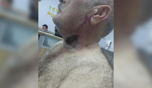 Yere d&uuml;ş&uuml;rd&uuml;, &uuml;st&uuml;nde tepindi: At, sahibini boğazından ısırdı!