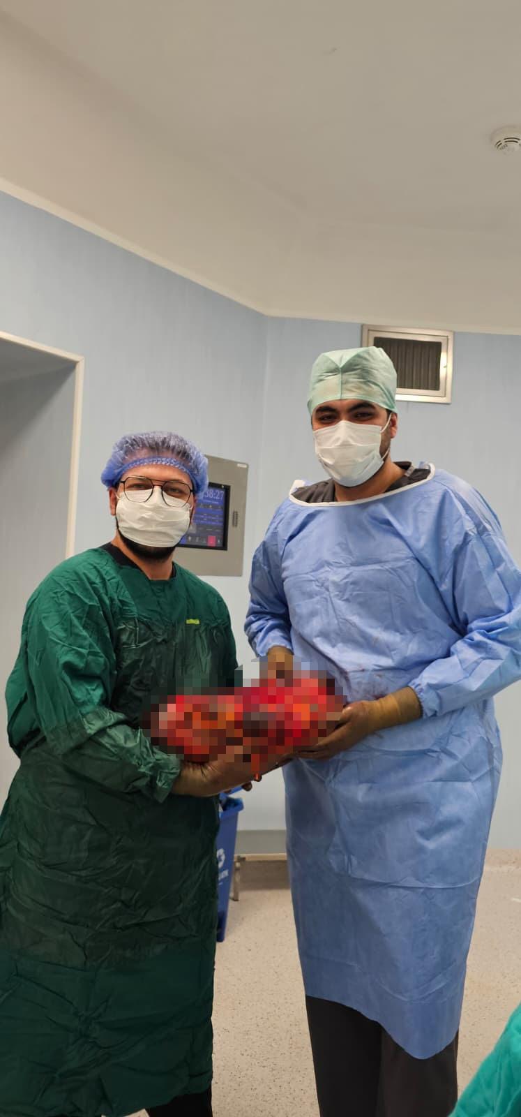 Mustafa Doğan (61) isimli hastadan çıkan 8 kilogramı aşkın böbrek.