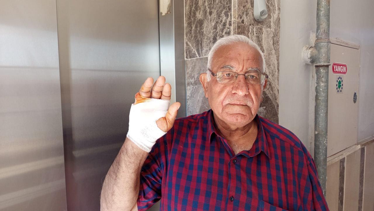  İsmail Bozdağ'ın (70) parmağı ampute oldu. 