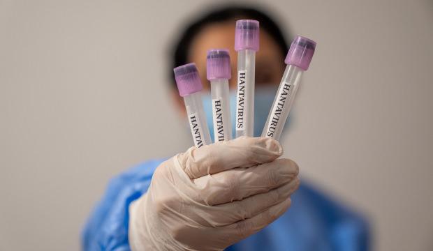 İngiltere&rsquo;den yeni hantavir&uuml;s a&ccedil;ıklaması: Gemide ş&uuml;phe artıyor
