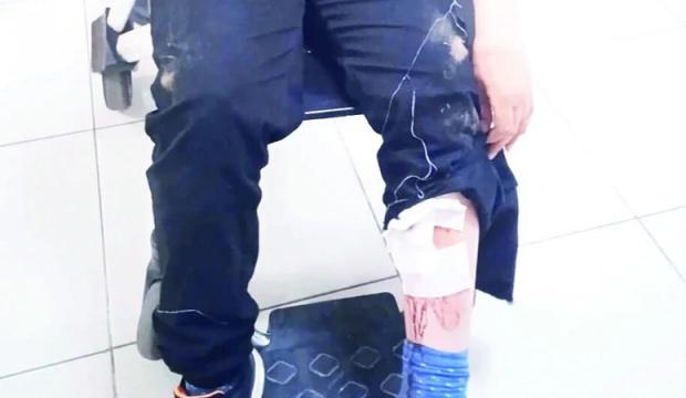 İstanbul'da başıboş k&ouml;pekler 10 yaşındaki Cemal'e okul &ccedil;ıkışı dehşeti yaşattı! 