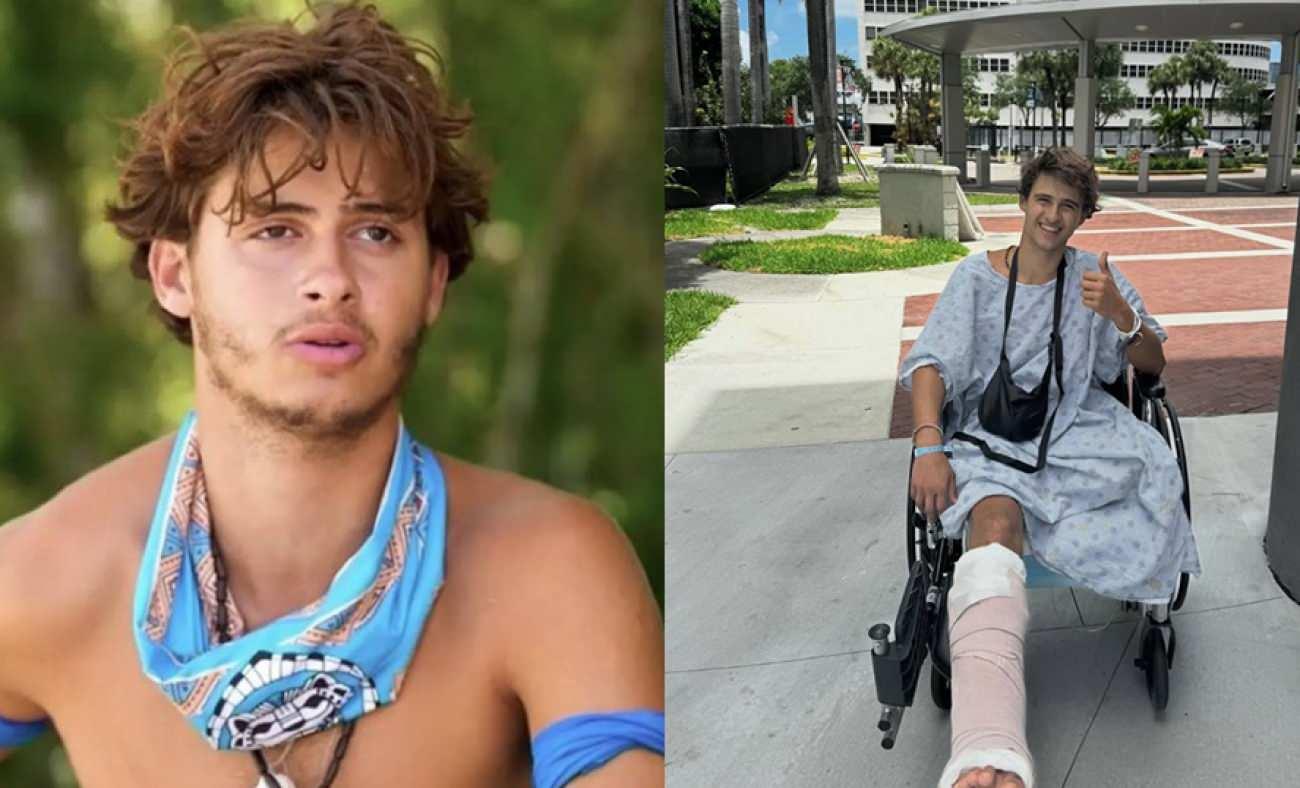 Bacağı ampute edilmişti! Survivor yarışmacısının son hali ortaya &ccedil;ıktı