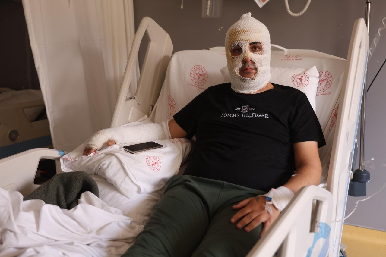 Ekmek teknesi küle dönmesin diye mücadele eden esnafın yüzü ve vücudu yaşanan patlamayla yandı.