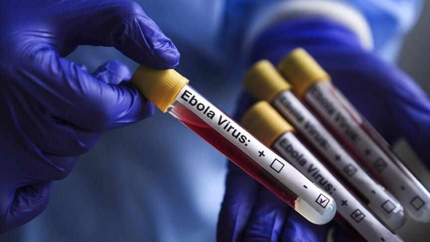 Ebola Virüsü nedir, belirtileri nelerdir?