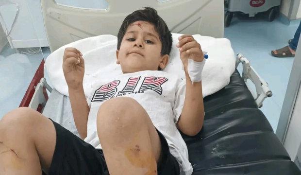 Başıboş k&ouml;pek saldırısıyla ilgili m&uuml;lkiye m&uuml;fettişi g&ouml;revlendirildi