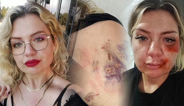 15 dakika boyunca bı&ccedil;aklanan &Ouml;zge: Bı&ccedil;ak kırılmasaydı zaten yaşama şansım yoktu