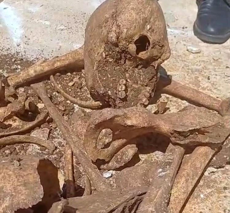 Malatya'da temel kazısında insan kemikleri bulundu.