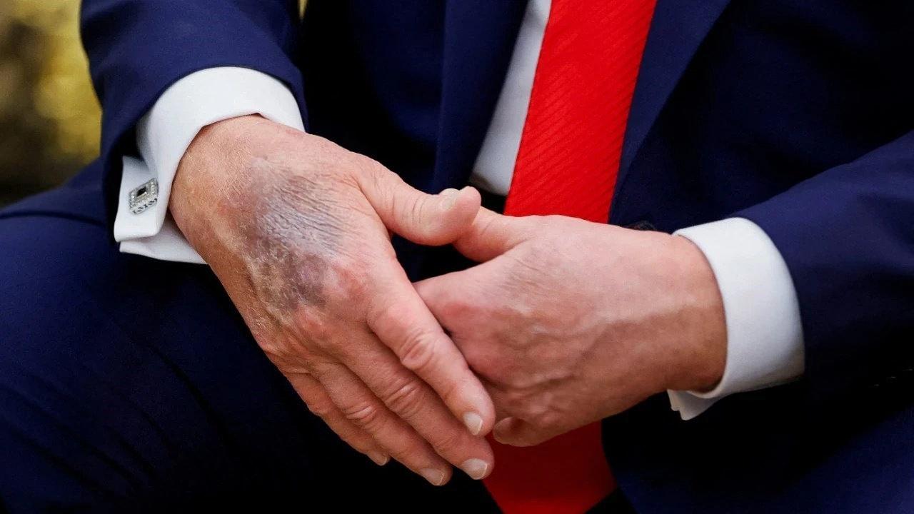 ABD Başkanı Donald Trump'ın konuşma yaparken çekilmiş fotoğrafı.