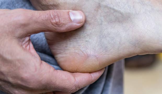 Vitrin hastalığına dikkat! Son yıllarda arttı: Sebebi ortaya &ccedil;ıktı