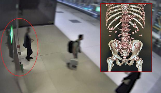 Y&uuml;r&uuml;mekte zorlanınca yakayı ele verdi! Midesinde tam 26 kaps&uuml;l uyuşturucu &ccedil;ıktı!
