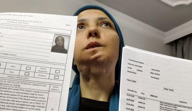 11 yılda 35 kez ameliyat oldu: 3 &ccedil;ocuk annesi kadının dili kesilebilir