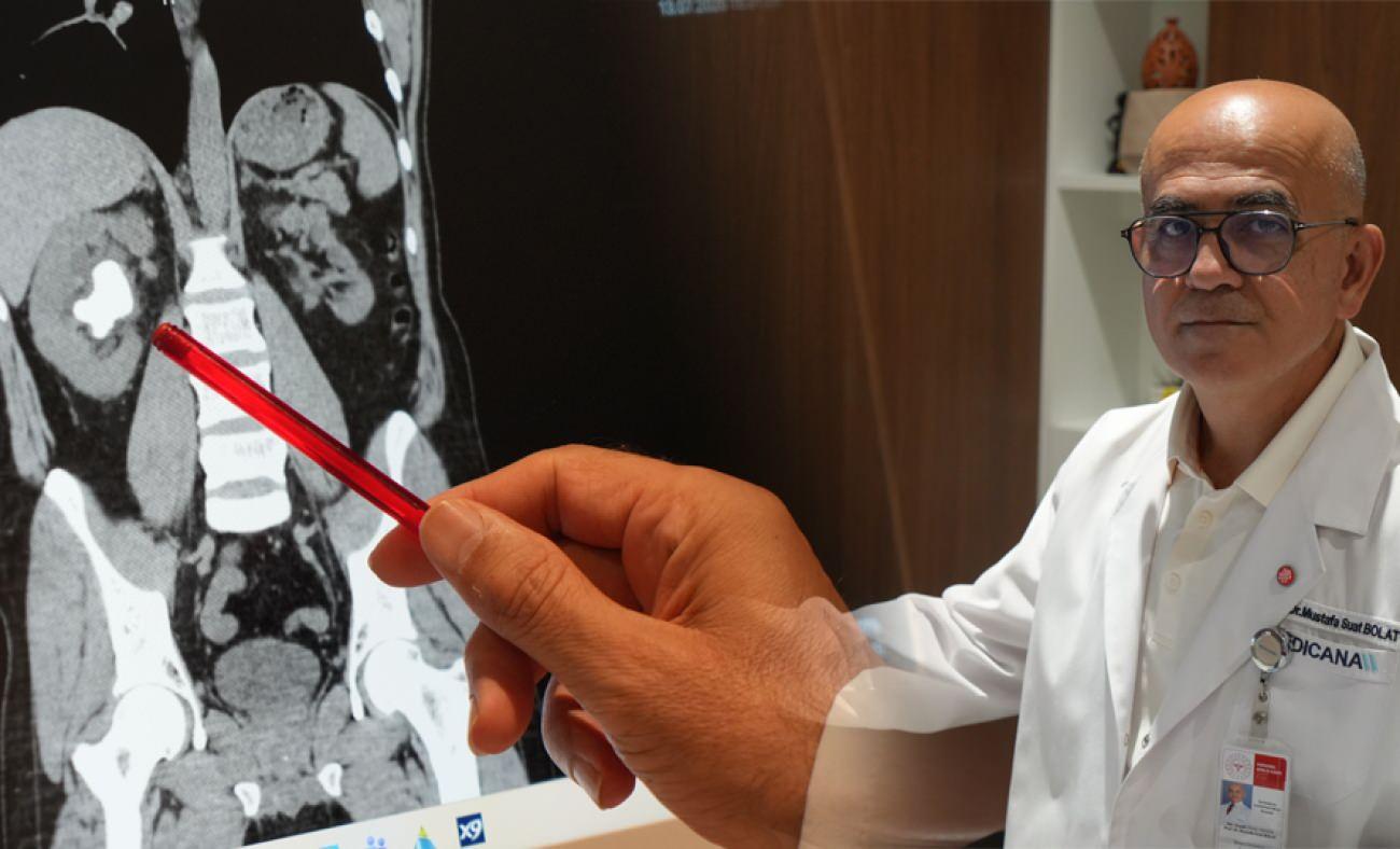 Dev b&ouml;brek taşını sırtından &ccedil;ıkarmak zorunda kaldı: Uzman doktor s&uuml;reci anlattı