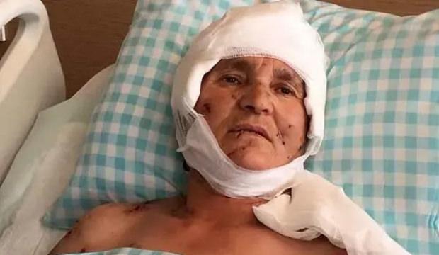 Kırşehir'de k&ouml;pek saldırısına uğrayan 63 yaşındaki kadına tazminat &ouml;denecek