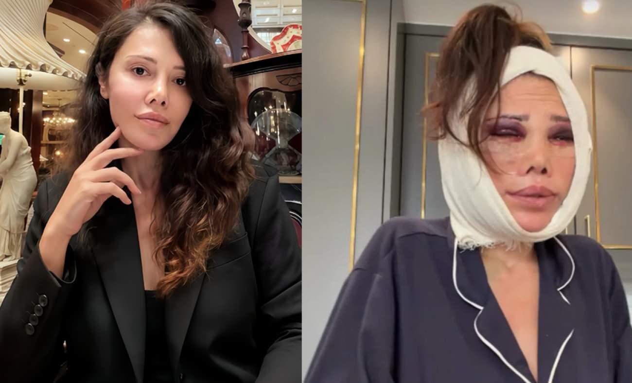 Kore'de iki kez y&uuml;z&uuml;n&uuml; gerdirdi! Didem Ceran'dan yeni ameliyat a&ccedil;ıklaması