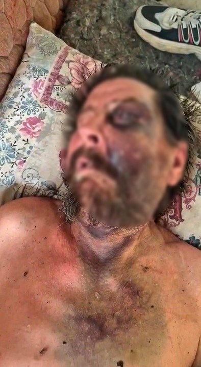 Yaralı bulunan adam ilk müdahalenin ardından hastaneye kaldırıldı. 