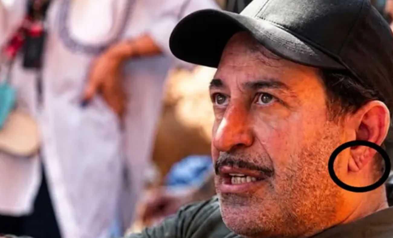 Cem Yılmaz'ın kalp krizi sonrası kulak memesindeki detay g&uuml;ndem oldu! 
