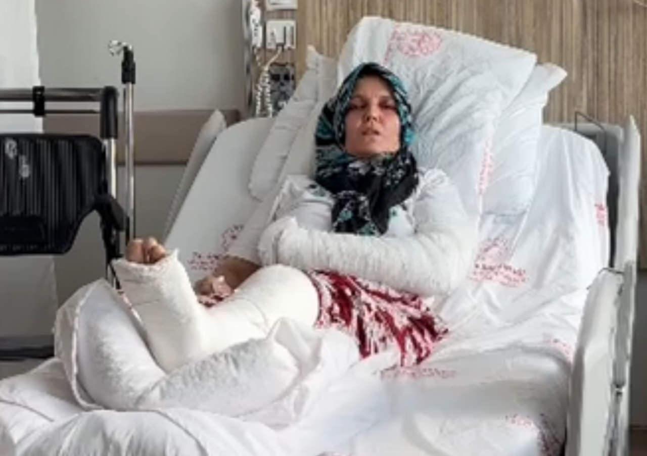 Kavgada 3 çocuk annesinin kolu ve bacağı kırıldı.