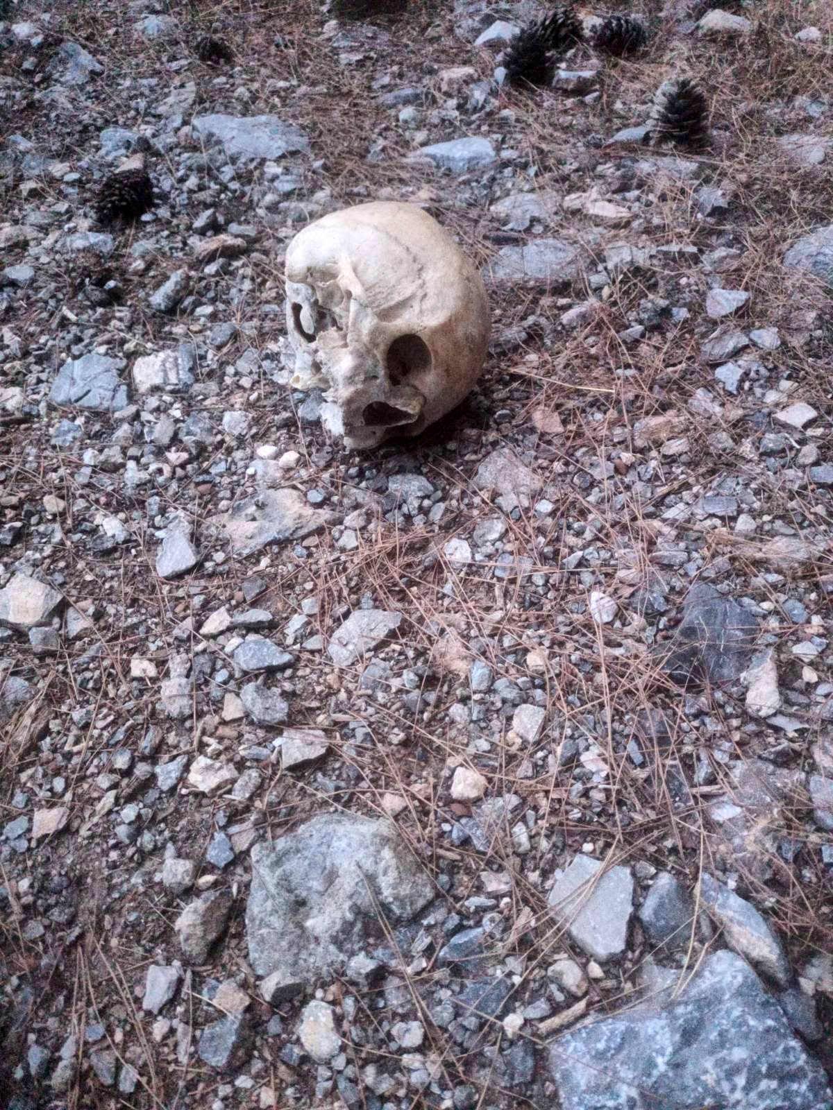 Hüseyin Karadeniz'a ait olduğu düşünülen kafatası.
