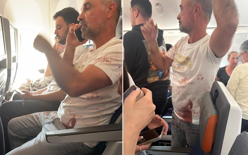 Acil durum yaşanan Flydubai'nin Dubai-Tel Aviv seferini yapan yolcu uçağında, yolcuların üzerinde kan lekeleri görüldü.