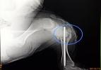 Bacağı kırılan buzağıya ameliyat
