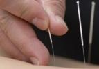 Akupunktur ile hamilelik ihtimali artırılabilir