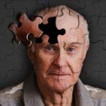 Alzheimer basit unutkanlıklarla başlar