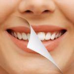 Sağlıklı dişler için 10 ipucu 