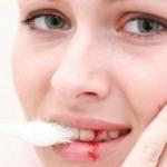 Diş eti hastalıkları erken doğuma neden olabiliyor