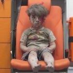 Halep'te Ümran gibi 100 bin çocuk var