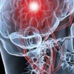 İnmede ilk 4,5 saat hayati önem taşıyor!