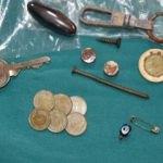 &Ccedil;ocukların yuttuğu cisimler şaşkına &ccedil;evirdi!